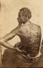 Peter, aka Gordon, a slave who was viciously beaten in Mississippi.  Photograph from 1863.
